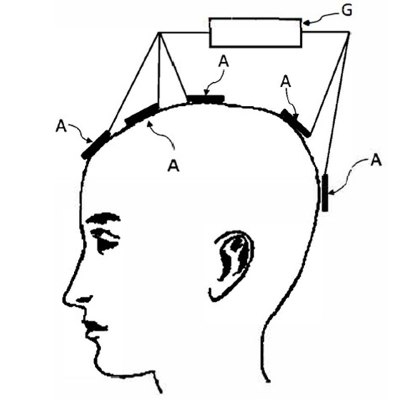 Exponatebilder_Paton_Stimulationskonfiguration